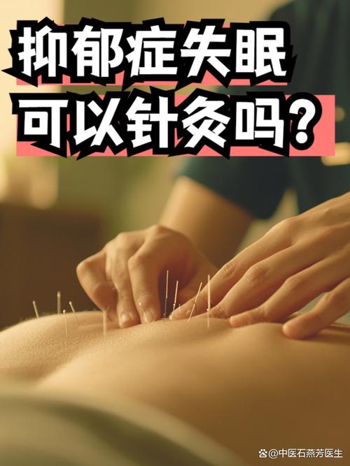 针灸到底有没有效果