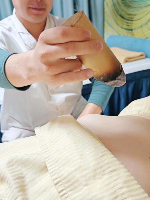 千年一贴 移动针灸