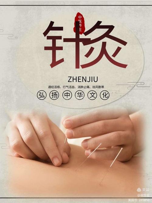 千年一贴 移动针灸