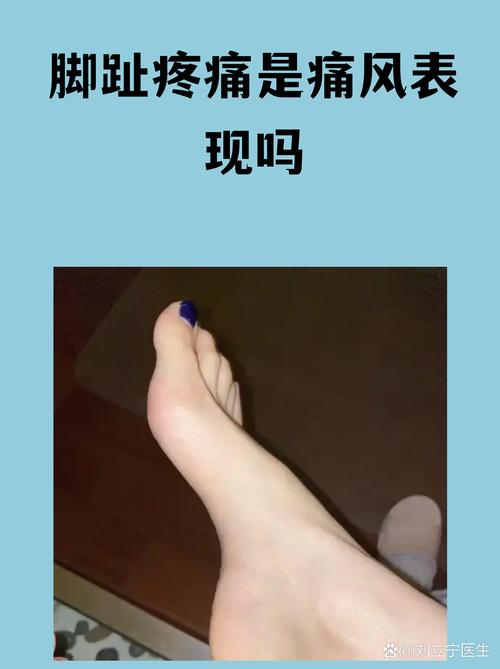 三脚趾疼痛是痛风吗