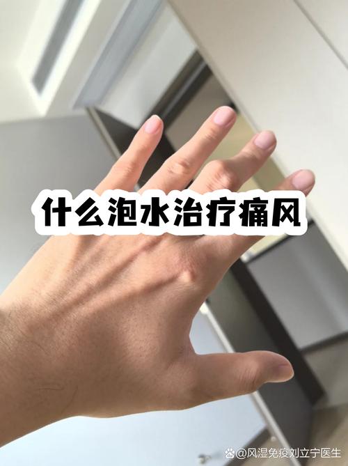 痛风能不能喝排骨汤