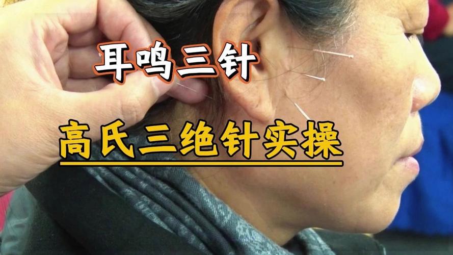 针灸治中耳炎后耳鸣