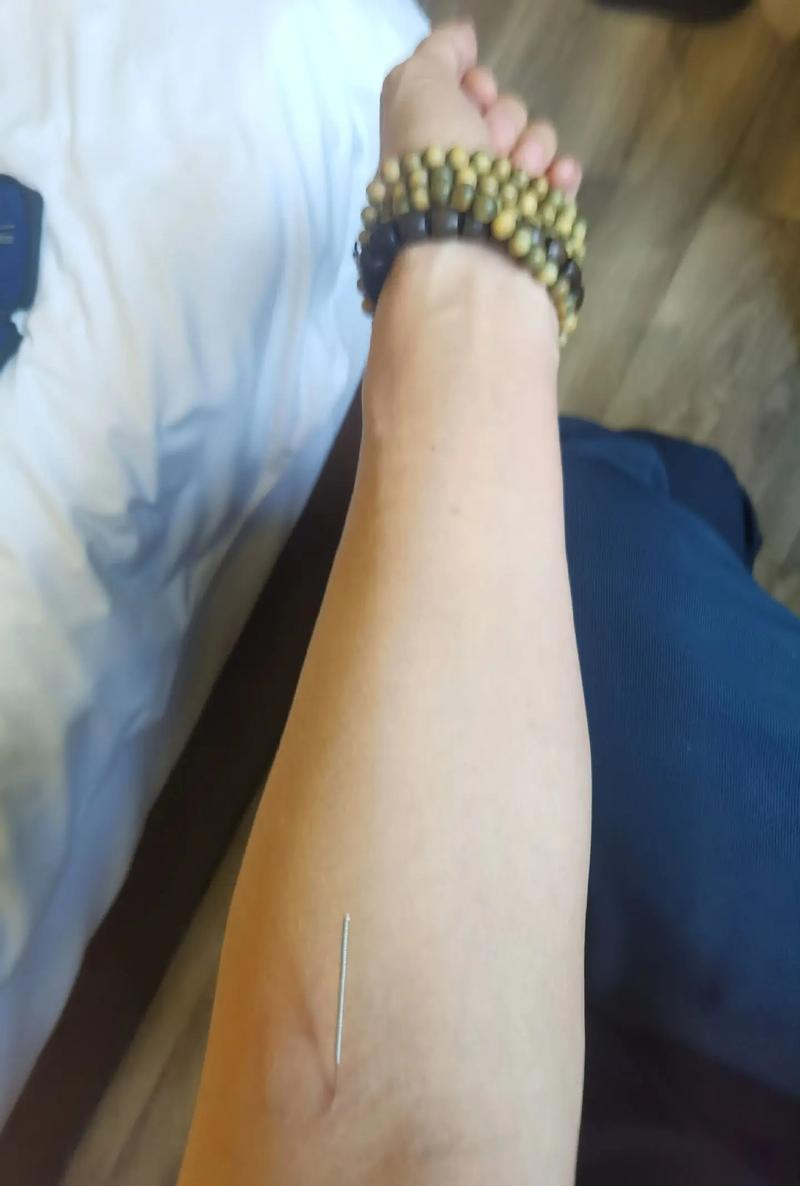 倪海厦针灸效果如何