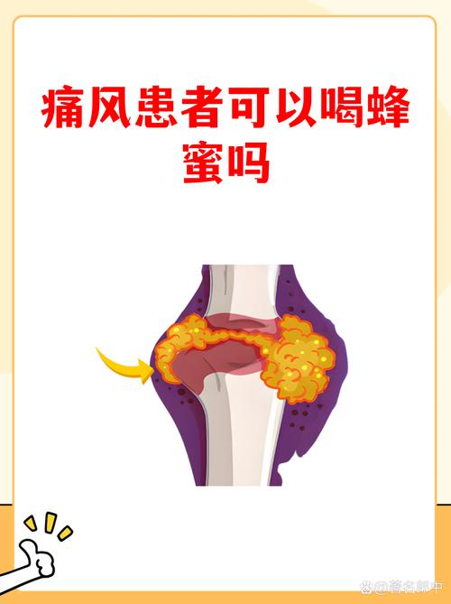 痛风病能喝蜂蜜水吗