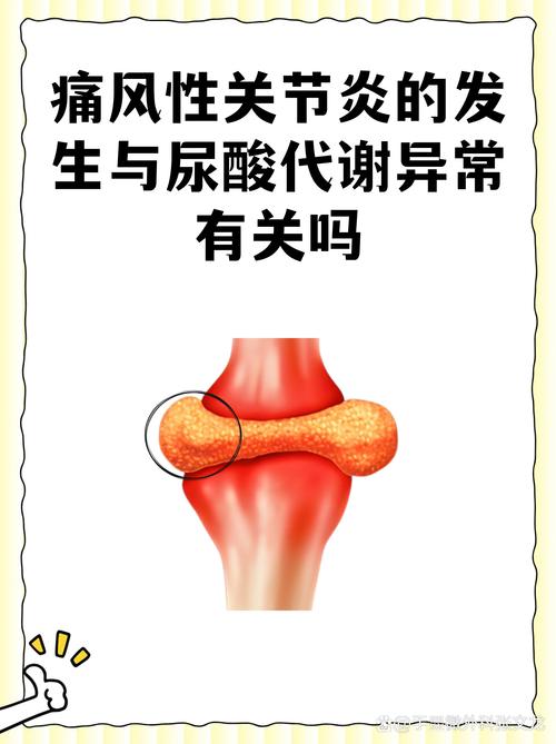 痛风与脑梗有无关系