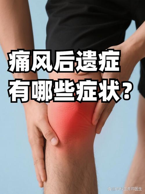 痛风关节炎一直不好