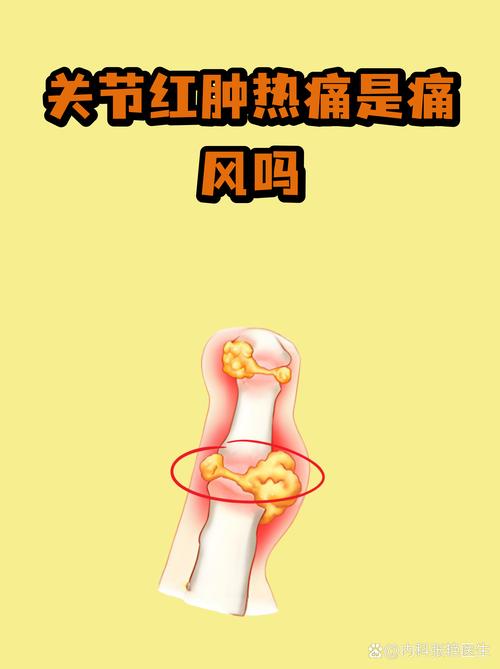 痛风病关节炎营养粥