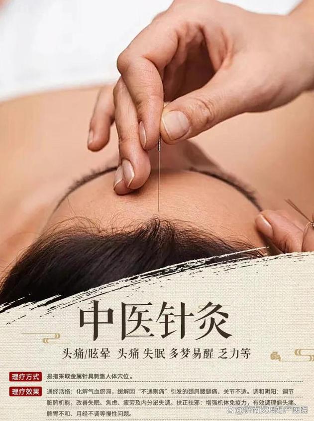 针灸能治疗打呼噜吗