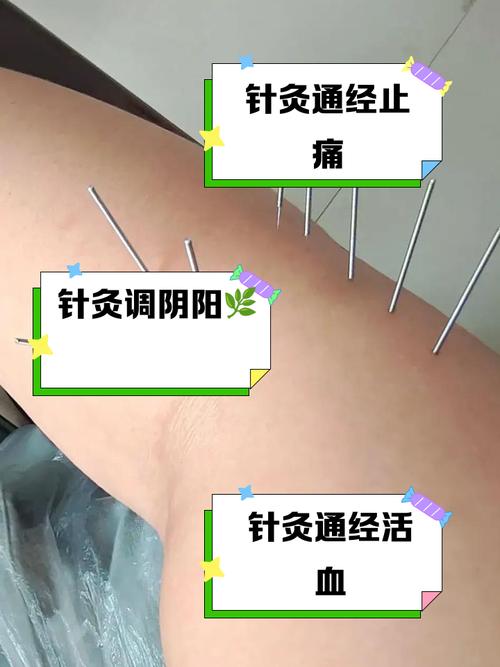 骨质增生针灸有用吗