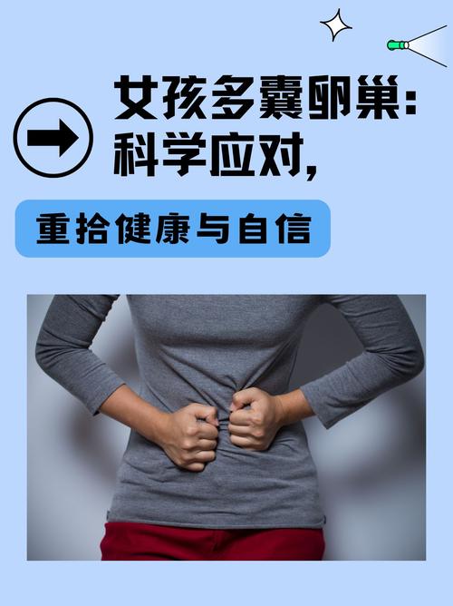 针灸多囊卵巢综合征