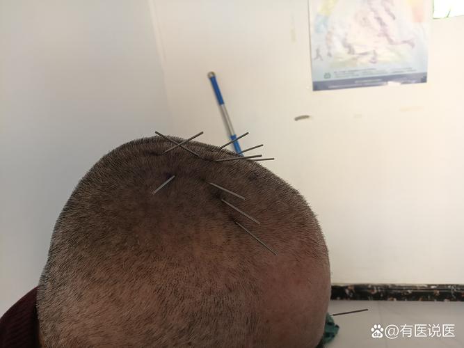 辽宁中医针灸成人班