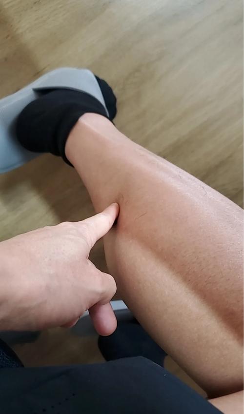 针灸腿以后一直抽筋