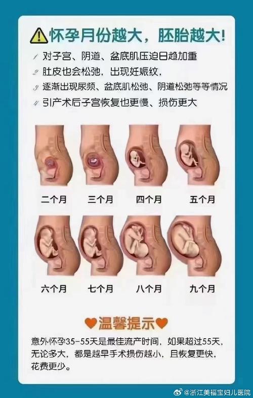 孕囊和刀口的安全距离