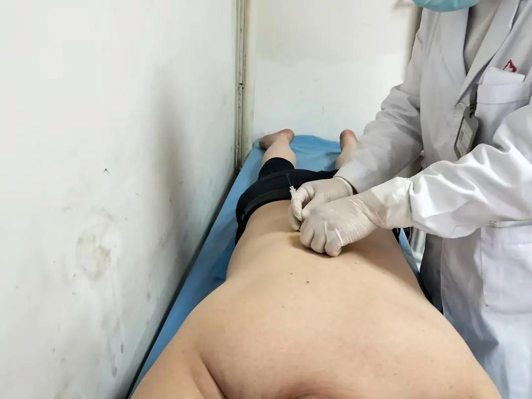 铜陵中医院针灸减肥