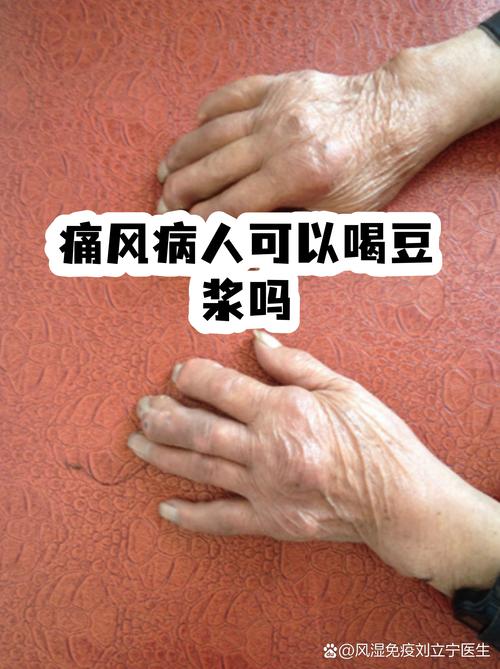 痛风病人能喝初元吗