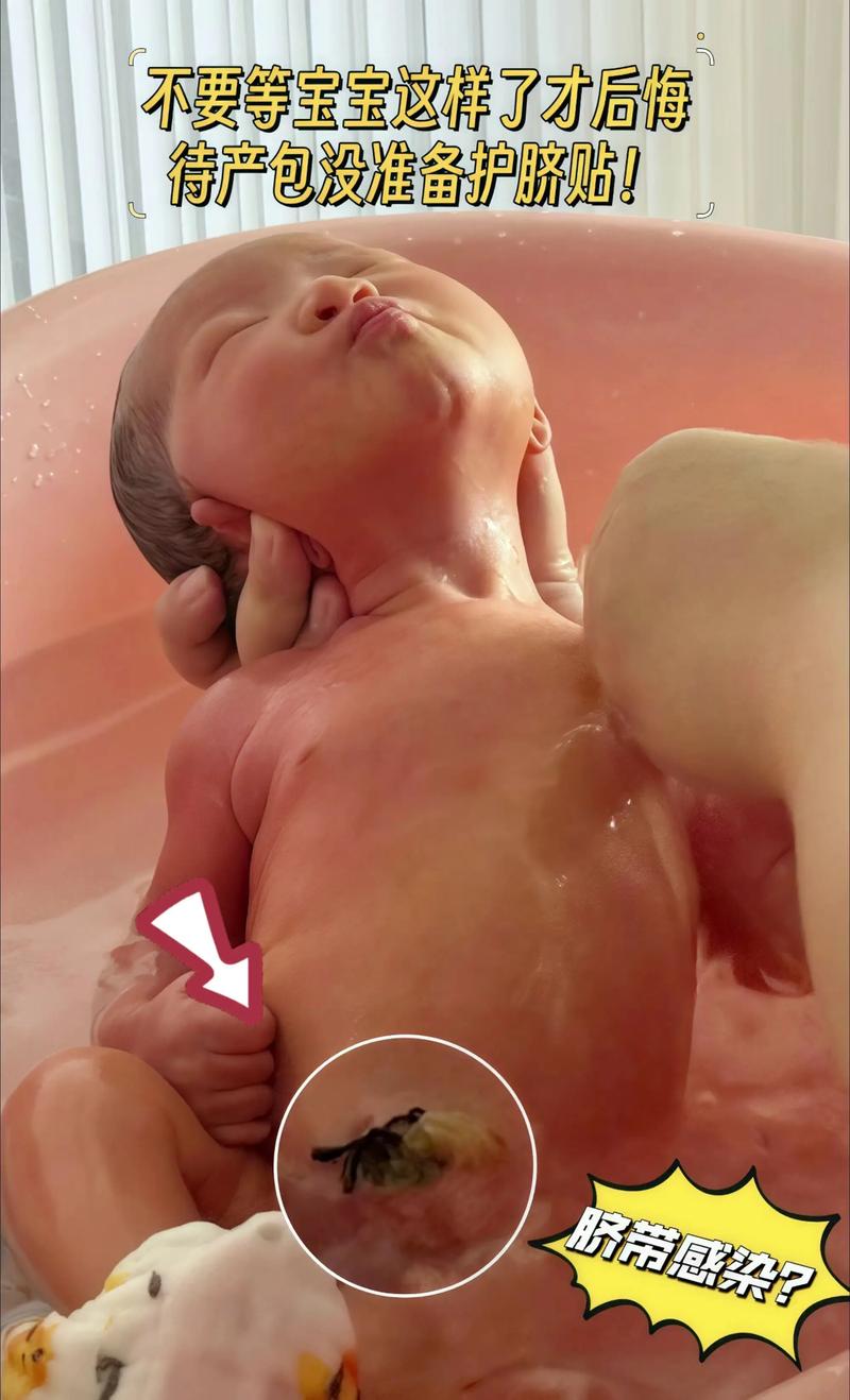 刨腹产宝宝缺乏安全感