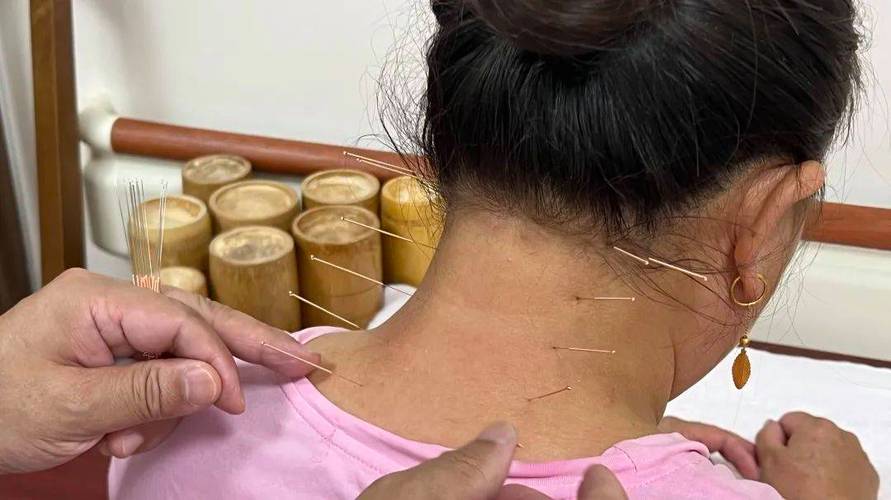 液体针灸治疗颈椎病