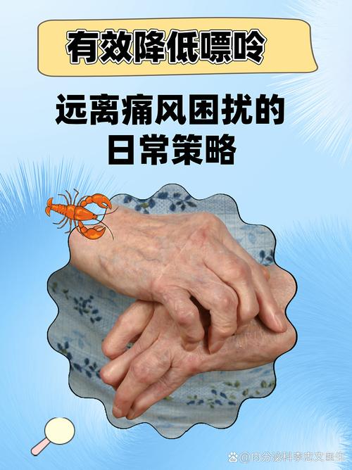 别嘌醇可以痛风石吗