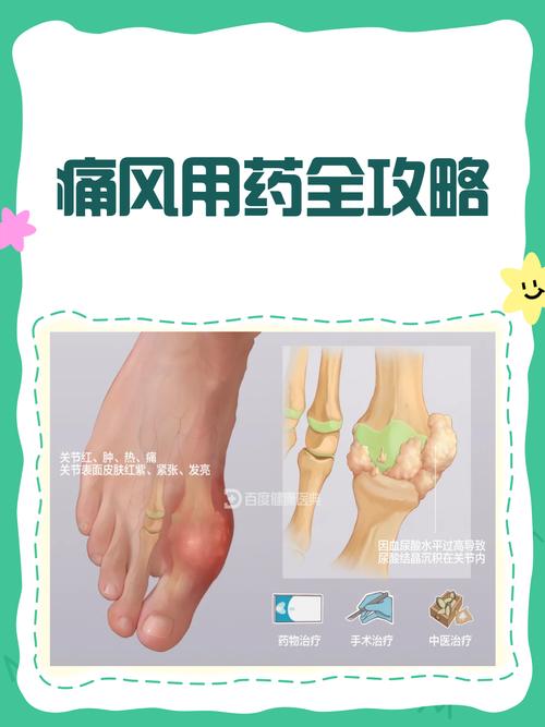 痛风发作期要吃药吗