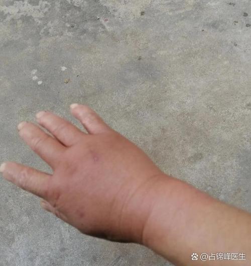 手握拳睡觉是没安全感