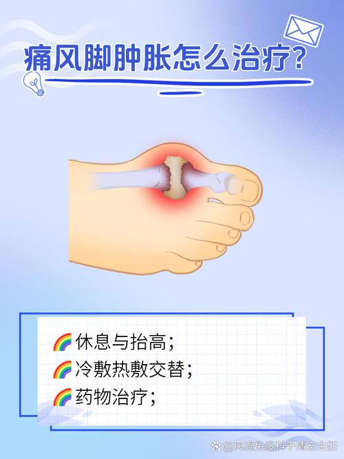 脚关节痛风如何治疗