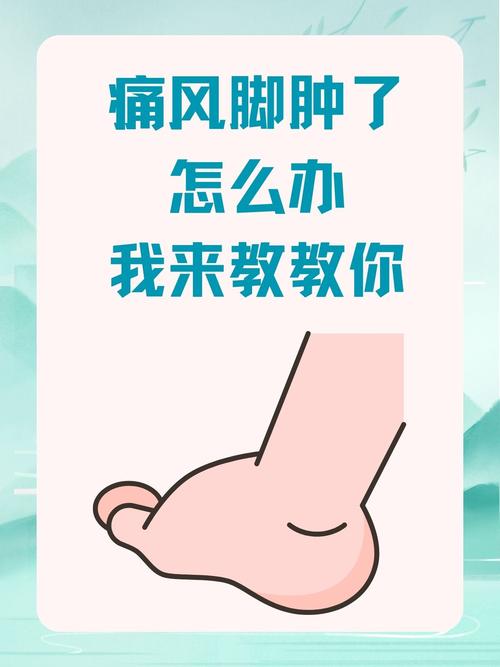 脚关节痛风如何治疗