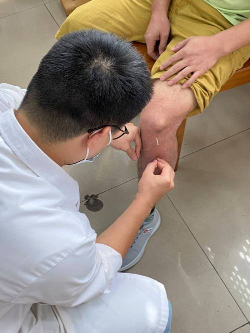 膝关节疼痛针灸视频