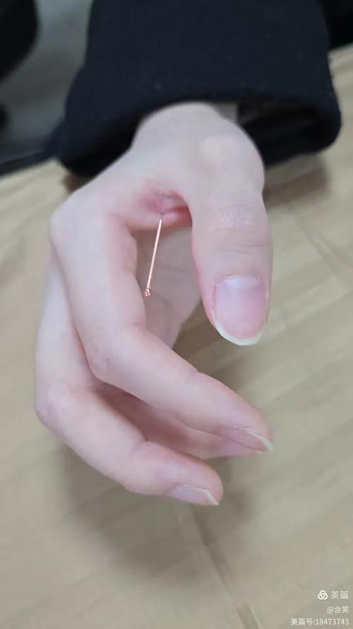 针灸的补泄手法视频