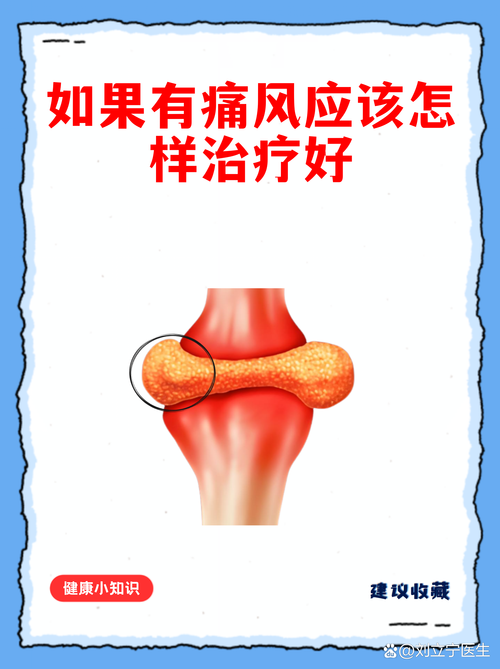 痛风关节炎多久能好