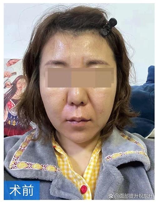 紫纤汇奕减减肥安全吗