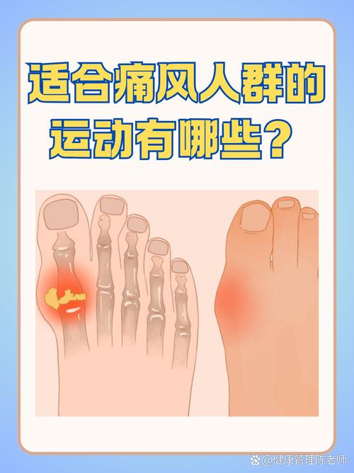 痛风关节炎能跑步吗