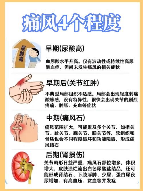 半夜痛风发作怎么办