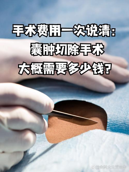 松果体囊肿手术安全吗