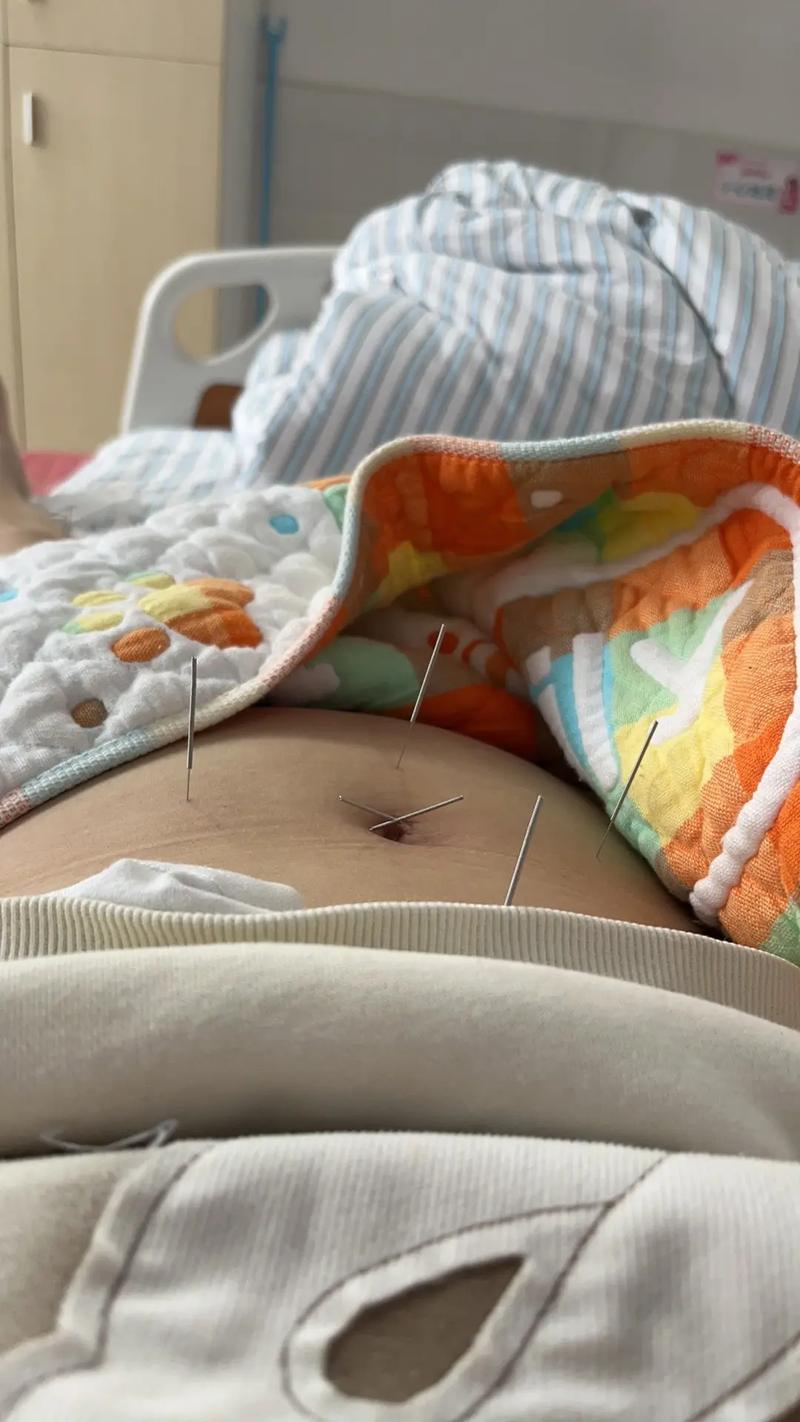 胃痛针灸有副作用吗