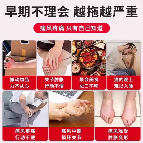 大母脚趾痛风怎么治