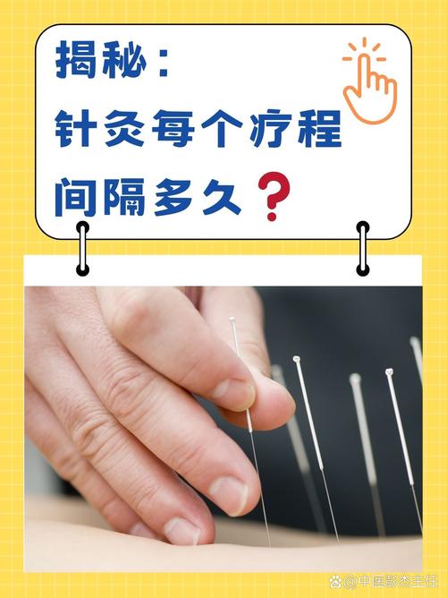 药流多久后可以针灸