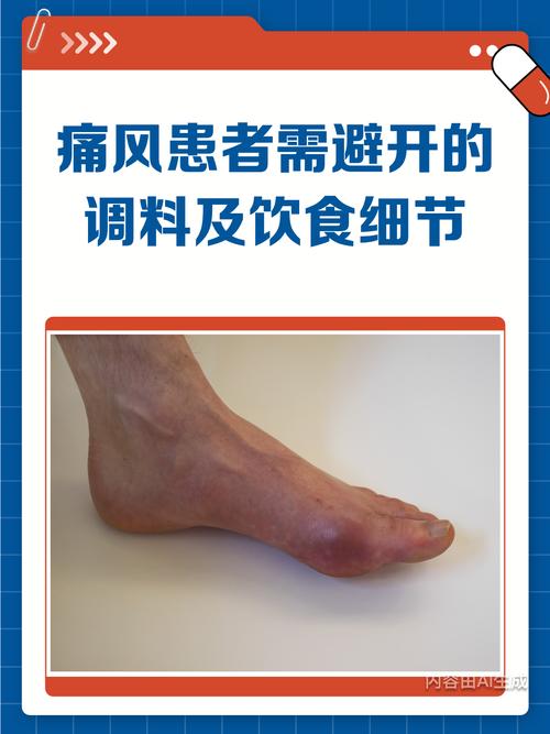 痛风不能吃什么调料