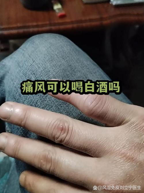 痛风可以喝玛卡酒吗