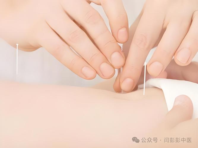 立水桥附近针灸减肥