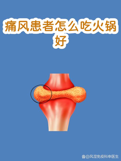 痛风能吃火锅羊肉吗