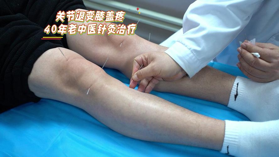 膝关节针灸图片大全