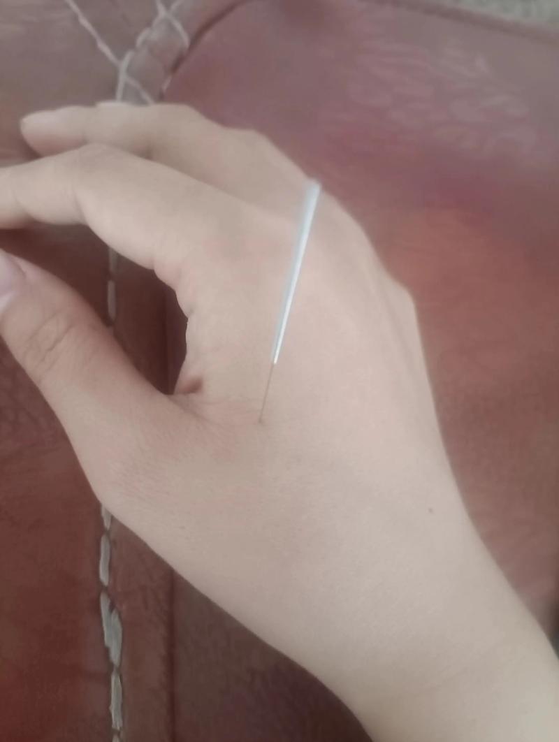 性功能障碍针灸位置