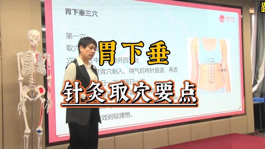 针灸能治疗胃下垂吗