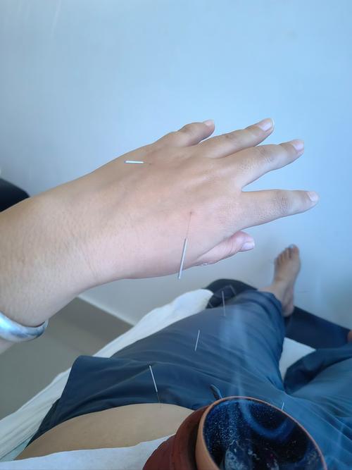 南京胡宗仁中医针灸