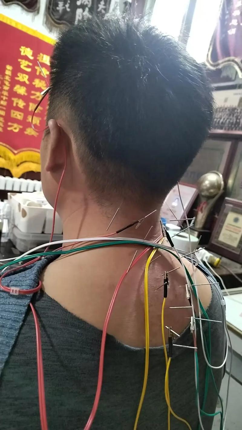 南京胡宗仁中医针灸