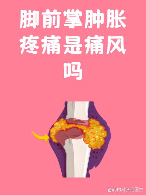 痛风为什么一直不好