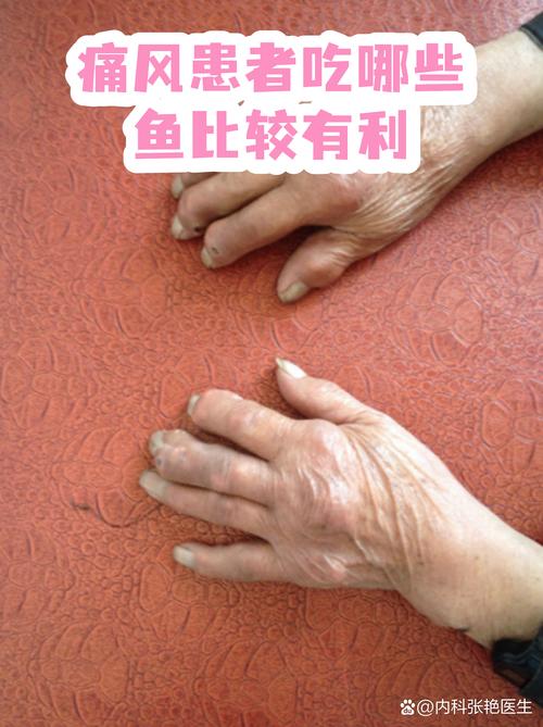 痛风能吃有鳞的鱼吗