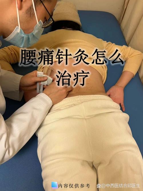 腰椎变直可以针灸吗