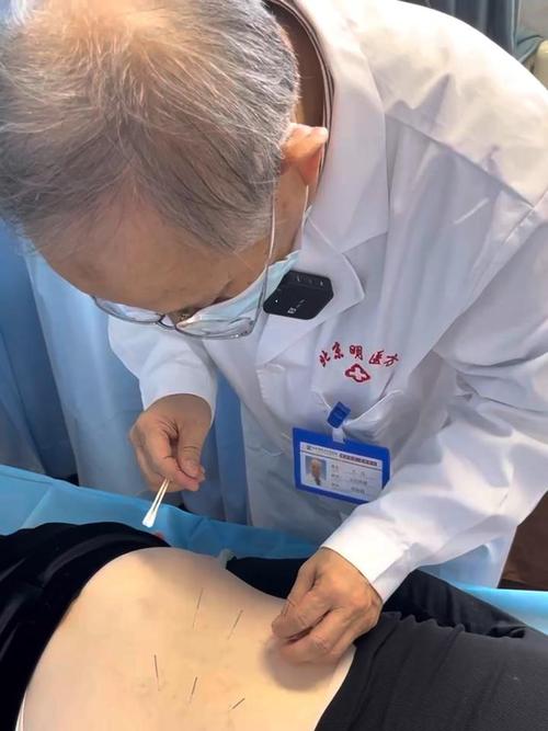 腰椎变直可以针灸吗