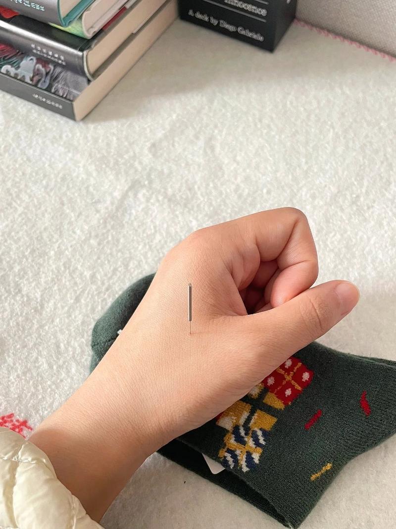 扎针灸能治疗痛经吗